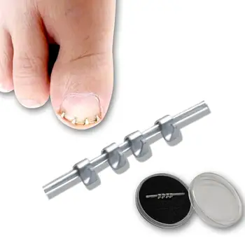 Професионален инструмент за корекция на врастнали нокти на пръстите на краката с тел заключващ механизъм за педикюр, за възстановяване на ноктите на краката, коректор за еднократна употреба 1БР